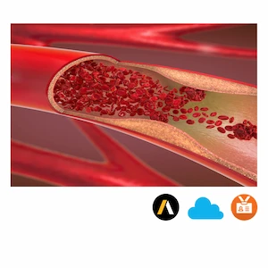 3D Bifurcating Artery